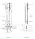Fig. 31 - Counter-torque implant