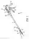Fig. 02 - Surgical Stapler with Controlled Healing