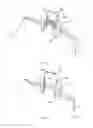 Fig. 05 - Tissue compression device for cardiac valve repair