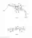 Fig. 09 - Tissue compression device for cardiac valve repair