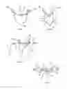 Fig. 11 - Tissue compression device for cardiac valve repair