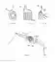 Fig. 12 - Tissue compression device for cardiac valve repair