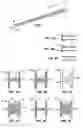 Fig. 02 - Tissue anchor for securing tissue layers