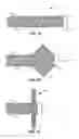 Fig. 03 - Tissue anchor for securing tissue layers