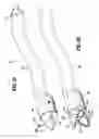 Fig. 18 - Flexible surgical stapler