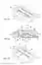Fig. 07 - TOURNIQUET