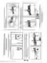 Fig. 11 - TOURNIQUET