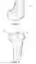 Fig. 02 - Methods and apparatus for performing knee arthroplasty