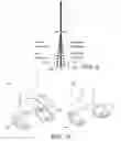 Fig. 06 - Methods and apparatus for performing knee arthroplasty