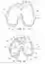 Fig. 10 - Methods and apparatus for performing knee arthroplasty