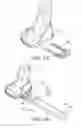 Fig. 13 - Methods and apparatus for performing knee arthroplasty