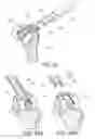 Fig. 14 - Methods and apparatus for performing knee arthroplasty