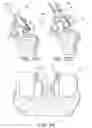 Fig. 15 - Methods and apparatus for performing knee arthroplasty