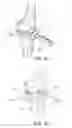 Fig. 17 - Methods and apparatus for performing knee arthroplasty