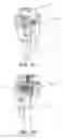Fig. 19 - Methods and apparatus for performing knee arthroplasty
