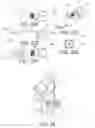 Fig. 20 - Methods and apparatus for performing knee arthroplasty