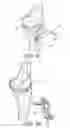 Fig. 31 - Methods and apparatus for performing knee arthroplasty