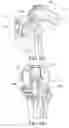 Fig. 34 - Methods and apparatus for performing knee arthroplasty