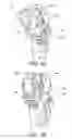 Fig. 35 - Methods and apparatus for performing knee arthroplasty