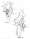 Fig. 36 - Methods and apparatus for performing knee arthroplasty