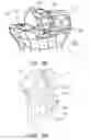 Fig. 47 - Methods and apparatus for performing knee arthroplasty