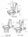 Fig. 55 - Methods and apparatus for performing knee arthroplasty