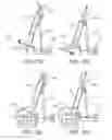 Fig. 57 - Methods and apparatus for performing knee arthroplasty