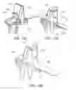 Fig. 59 - Methods and apparatus for performing knee arthroplasty