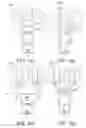 Fig. 61 - Methods and apparatus for performing knee arthroplasty