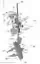 Fig. 01 - Tibia cutting assembly