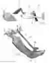 Fig. 02 - Tibia cutting assembly