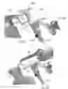 Fig. 12 - Tibia cutting assembly