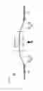 Fig. 13 - Medical device and treatment method