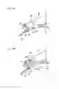 Fig. 16 - Medical device and treatment method