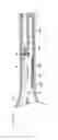 Fig. 21 - Medical device and treatment method