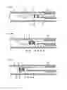 Fig. 05 - Medical device and treatment method