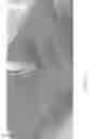 Fig. 126 - Pixel array medical systems, devices and methods