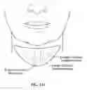 Fig. 130 - Pixel array medical systems, devices and methods