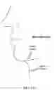 Fig. 132 - Pixel array medical systems, devices and methods
