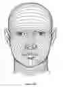 Fig. 133 - Pixel array medical systems, devices and methods