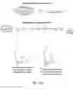 Fig. 140 - Pixel array medical systems, devices and methods