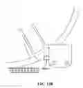 Fig. 16 - Pixel array medical systems, devices and methods