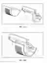 Fig. 25 - Pixel array medical systems, devices and methods