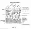 Fig. 35 - Pixel array medical systems, devices and methods