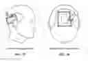 Fig. 37 - Pixel array medical systems, devices and methods