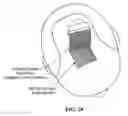 Fig. 38 - Pixel array medical systems, devices and methods