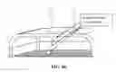 Fig. 80 - Pixel array medical systems, devices and methods