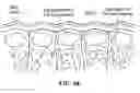 Fig. 88 - Pixel array medical systems, devices and methods