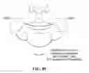 Fig. 89 - Pixel array medical systems, devices and methods