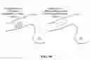 Fig. 94 - Pixel array medical systems, devices and methods